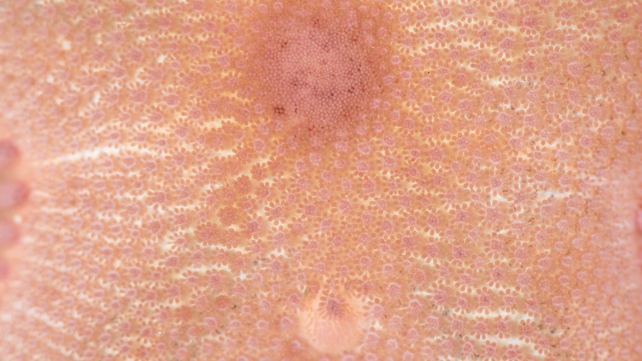 Do OTC Skin Tag Removers Really Work?