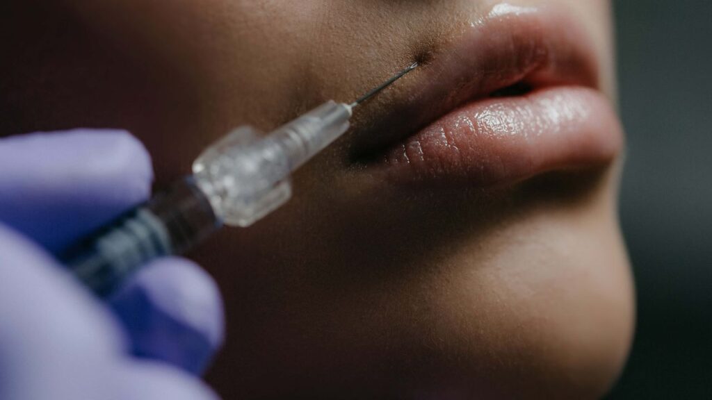 How to Get Rid of Dark Skin Around Lips