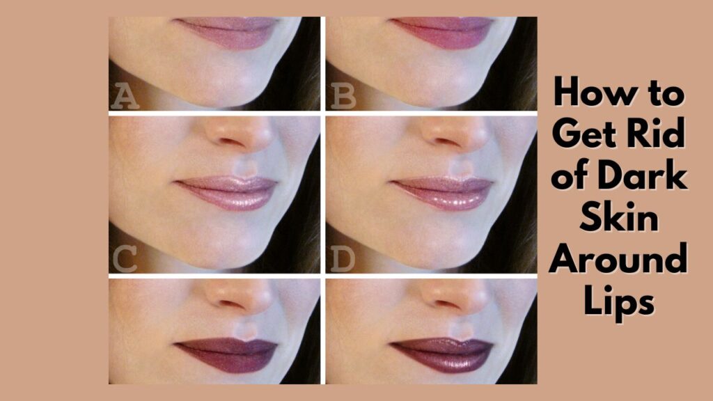 How to Get Rid of Dark Skin Around Lips