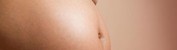 How to Get Rid of Excess Skin After Pregnancy